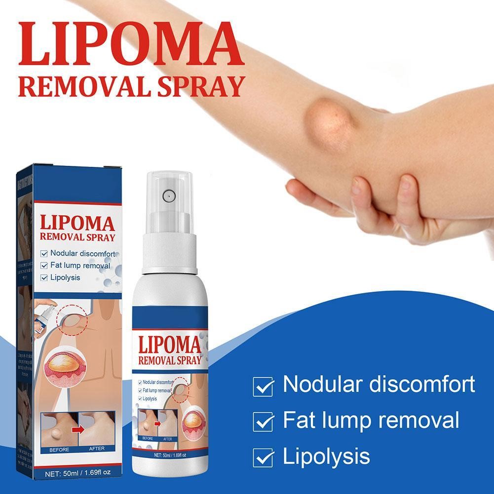 50ml lipomheilung spray, reduction instant lumpcomplimentary spray lipoma remova