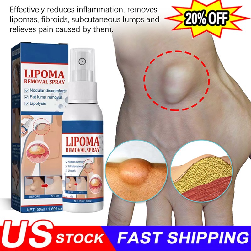 50ML Lipomheilung Reduction Spray, Instant LumpFree Lipoma Spray Removal