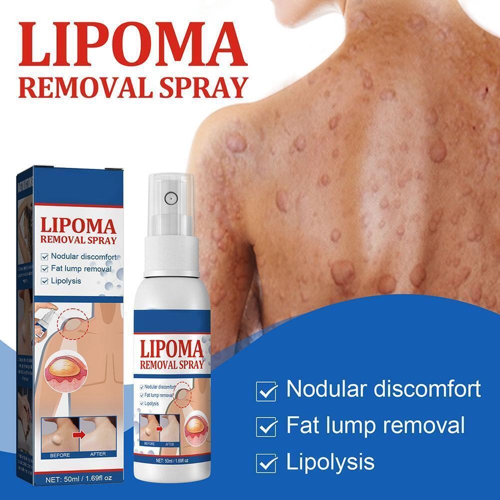 50ml lipomheilung spray, reduction instant lumpcomplimentary spray lipoma remova