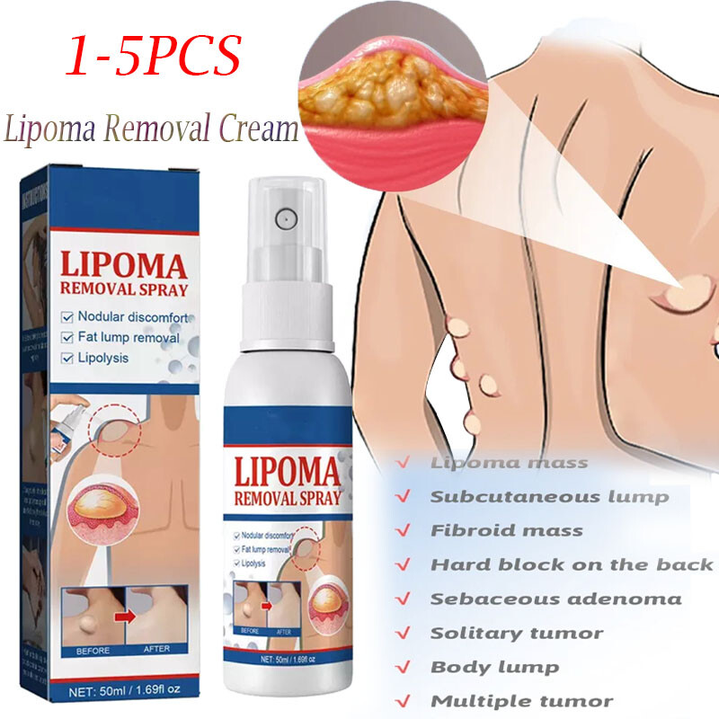 1-5PC Lipomheilung Reduction Spray,Instant LumpFree Lipoma Removal Spray USA Hot