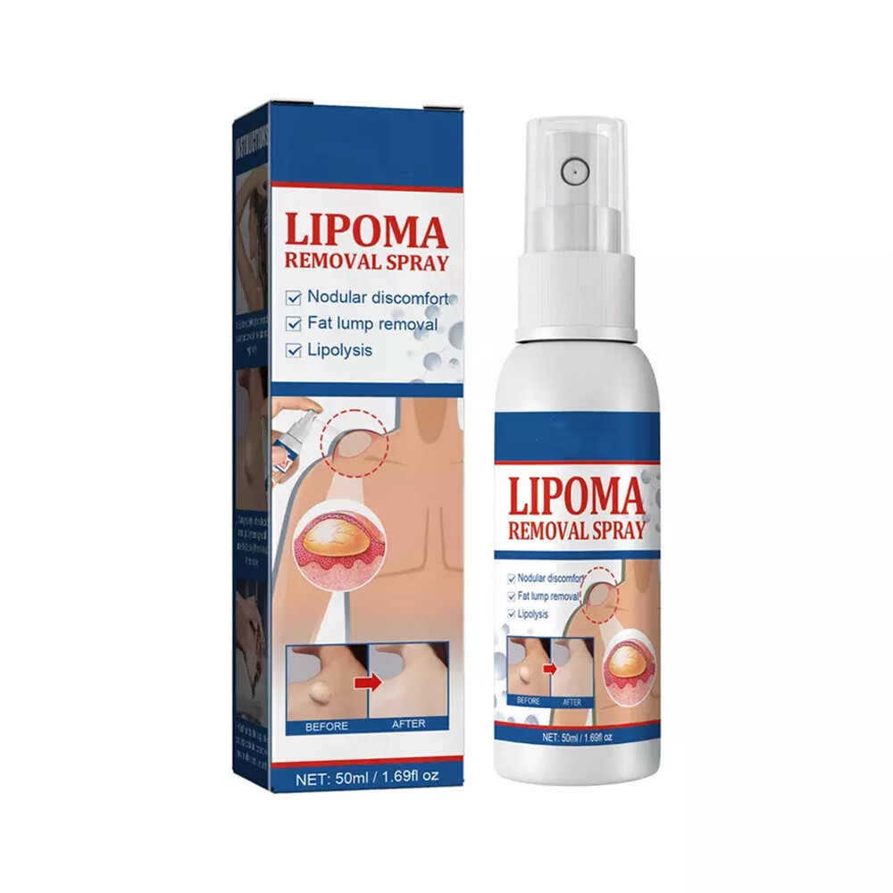 50ML Lipomheilung Reduction Spray, Instant LumpFree Lipoma Removal Spray Hot USA