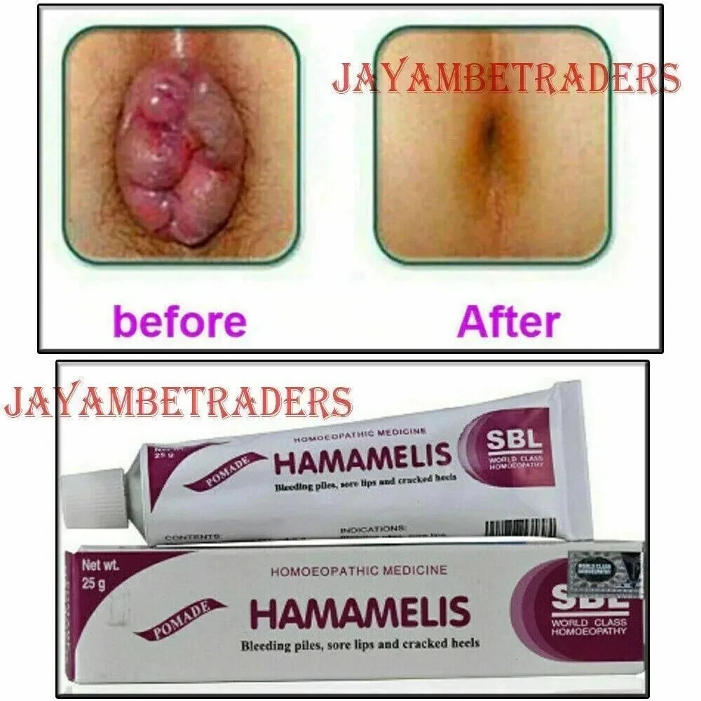PACK 2 x HAMAMELIS CREAM Stop Permanent Piles Pain Swelling Hemorrhoids Relives
