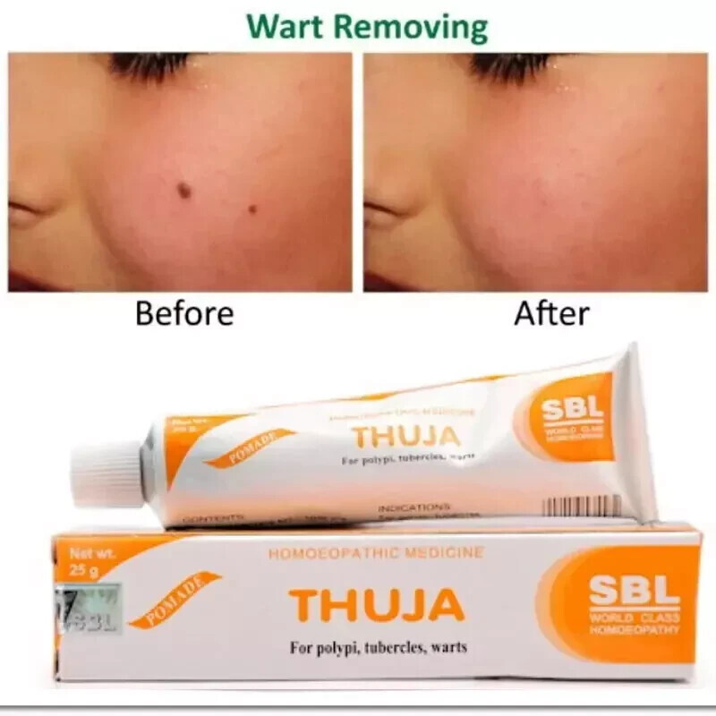 SBL Thuja Homeopathic Cream 25g Ointment Buy 2 Get 1 Free