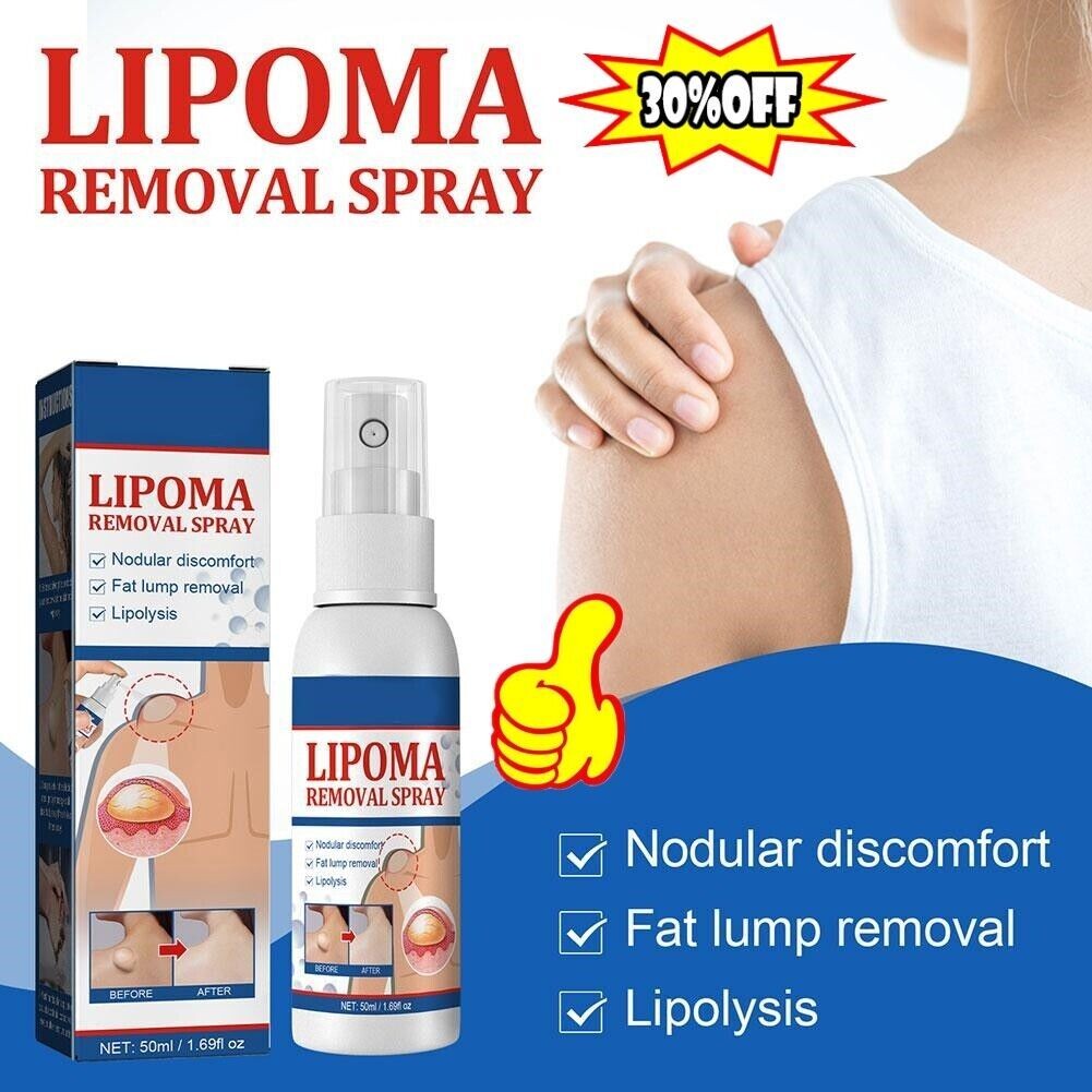 50ml lipomheilung spray, reduction instant lumpcomplimentary spray lipoma remova