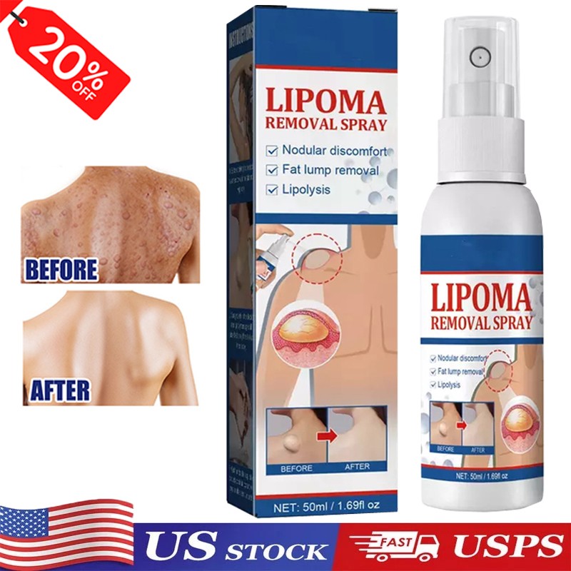 50ML Lipomheilung Reduction Spray, Instant LumpFree Lipoma Removal Spray