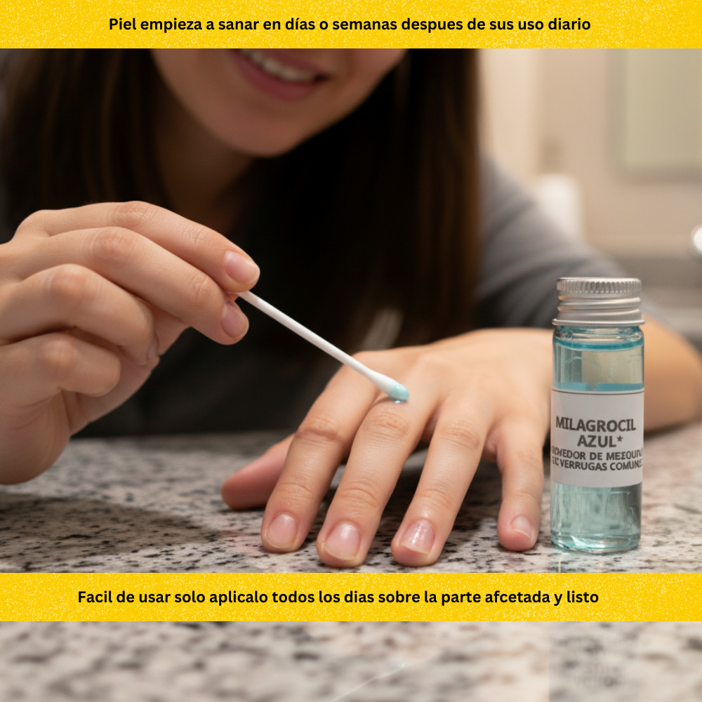 Remedio Para mezquinos o verrugas vulgares en Manos y Cuerpo Funciona Sin Dolor