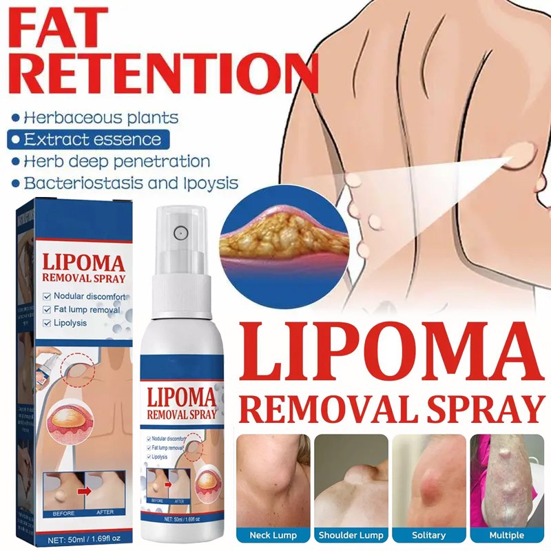 50ML Lipomheilung Reduction Spray, Instant LumpFree Lipoma Removal Spray