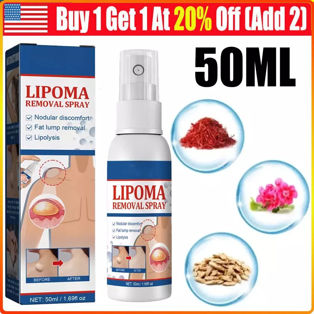 50ML Lipomheilung Reduction Spray, Instant LumpFree Lipoma Removal Spray USA Hot