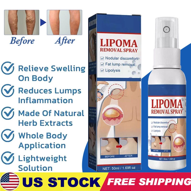 50ML Lipomheilung Reduction Spray, Instant LumpFree Lipoma Removal Spray USA Hot