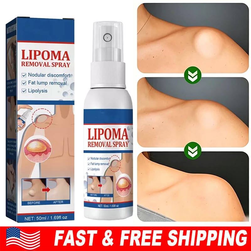 50ML Lipomheilung Reduction Spray, Instant LumpFree Lipoma Removal Spray